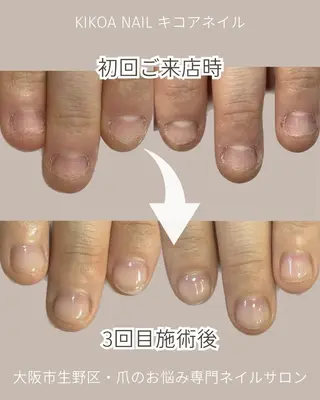 ネイル KIKOA NAIL キコアネイルのネイルデザイン