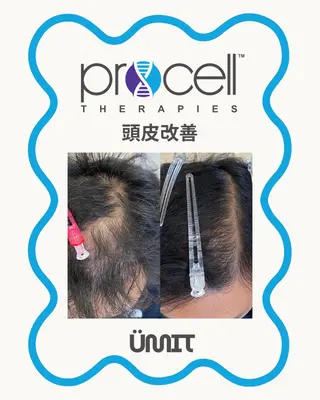 メンズ Ümit(ユミト) プロセルセラピーズのヘアスタイル