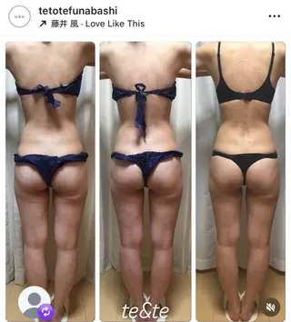 痩身・ブライダル te&te  テトテのエステ・リラクイメージ
