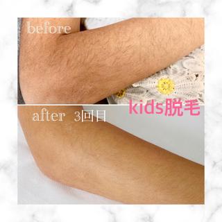 キッズ 脱毛&フェイシャル NO.511のエステ・リラクイメージ