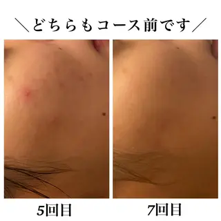 Bellesthe (ベルエステ)のエステ・リラクイメージ