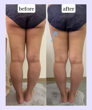💜Karen PrivateSpaのエステ・リラクイメージ