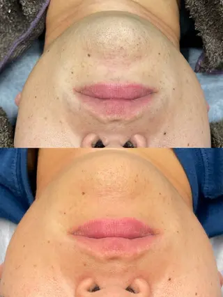 Tug 高知駅前店/ NANAMI🌐のエステ・リラクイメージ