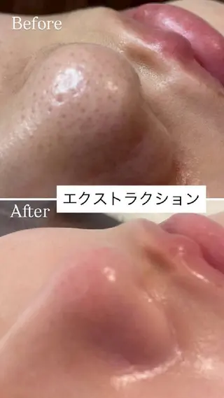 Luv the TERRACEのエステ・リラクイメージ