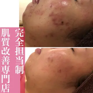 ミディアム カラー パーマ ヘアアレンジ メンズ キッズ ネイル マツエク・マツパ ニキビ・肌質改善専門 ♡人生が変わるサロンのエステ・リラクイメージ