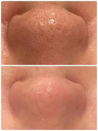 Whitening Beauty 行橋店のその他イメージ