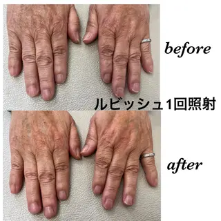 ネイル Regene ARAKIのネイルデザイン