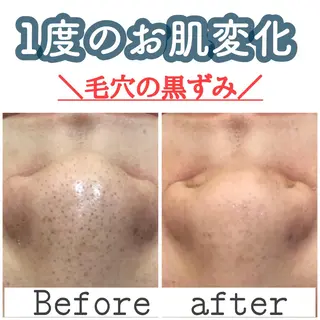 ショート カラー パーマ ヘアアレンジ メンズ キッズ ネイル マツエク・マツパ ニキビ&跡改善サロン オーナー光木のエステ・リラクイメージ