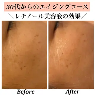 Bellesthe (ベルエステ)のエステ・リラクイメージ