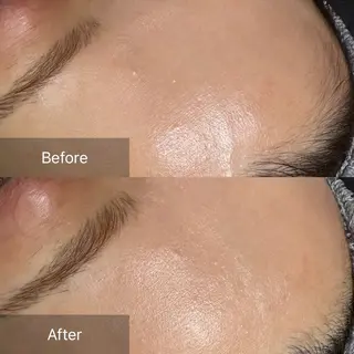 enine フェイスWAXのエステ・リラクイメージ