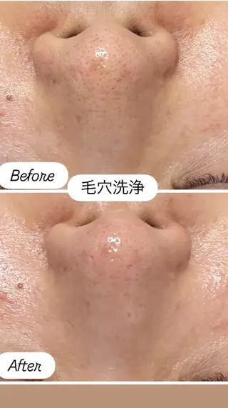 看護師 桐山 まどかのエステ・リラクイメージ