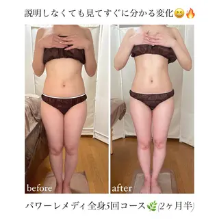 《本気痩せ×疲労改善 》  BILOOPのエステ・リラクイメージ