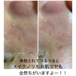 毛穴洗浄美肌プリート Pulitoのエステ・リラクイメージ