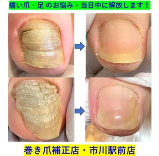 大木 祐作のネイルデザイン