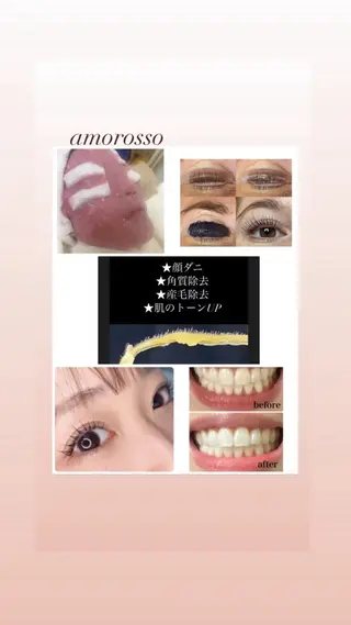 マツエク・マツパ アモロッソ 🐻Miiのマツエク・マツパデザイン