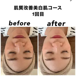 ネイル・エステサロン UILANIのエステ・リラクイメージ