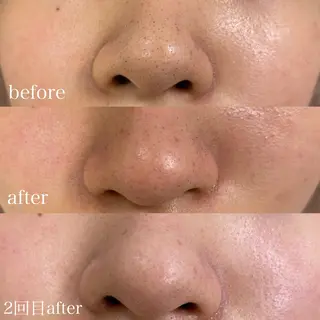 mish eyebrowのエステ・リラクイメージ