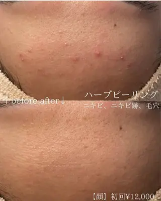 毛穴改善サロン d'Alba大阪住吉のエステ・リラクイメージ