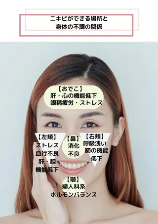 肌質改善美容鍼 ×ハーブピーリングのエステ・リラクイメージ
