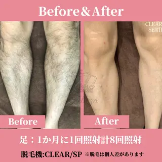 メンズ 有人型セルフサロン 脱毛/痩身/美顔のエステ・リラクイメージ
