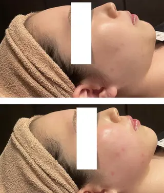 👑Linola👑 レイビス 纐纈のエステ・リラクイメージ