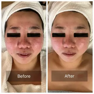 エステサロン Minkのエステ・リラクイメージ