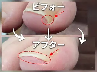 ネイル&巻き爪サロン AKnailのネイルデザイン