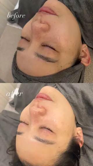 艶肌デトックス🫧 Samiraのエステ・リラクイメージ