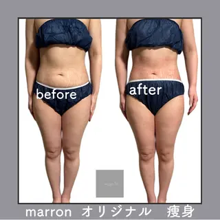 痩身ハイパーナイフ ララピールリアボーテのエステ・リラクイメージ