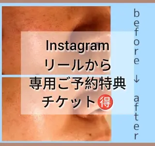 小顔/毛穴/POLA 心斎橋難波5分のエステ・リラクイメージ