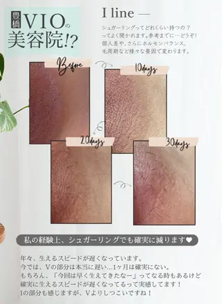 豊橋 |Hitomi シュガーリング専門店のその他イメージ