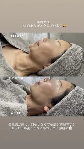 cocofleur 美容看護師監修サロンのエステ・リラクイメージ