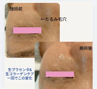 cocojujur バリ式リンパ＆美肌のエステ・リラクイメージ