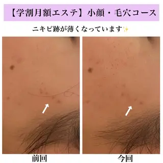 Bellesthe (ベルエステ)のエステ・リラクイメージ