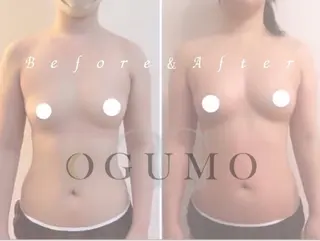 肌管理 OGUMOのエステ・リラクイメージ