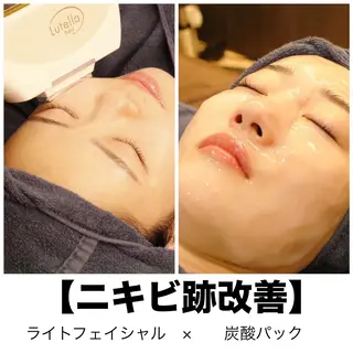leolo武蔵浦和 肌質改善&脱毛のエステ・リラクイメージ