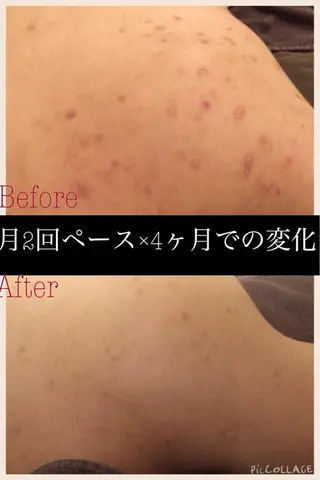 ミディアム カラー パーマ ヘアアレンジ メンズ キッズ ネイル マツエク・マツパ ニキビ・肌質改善専門 ♡人生が変わるサロンのエステ・リラクイメージ
