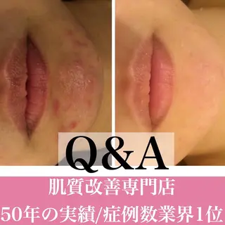 ミディアム カラー パーマ ヘアアレンジ メンズ キッズ ネイル マツエク・マツパ ニキビ・肌質改善専門 ♡人生が変わるサロンのエステ・リラクイメージ