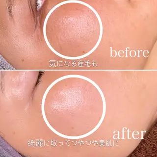 宮崎 泉空のエステ・リラクイメージ