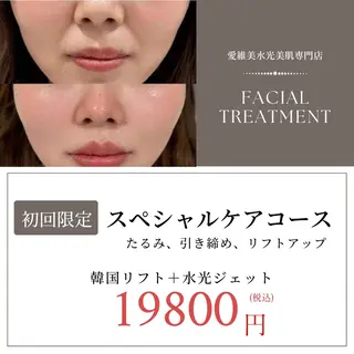 愛維美水光美肌専門店 メンズレディースokのエステ・リラクイメージ