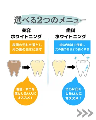 東区香椎歯のセルフホ ワイトニングGLOWのその他イメージ