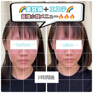 鍼灸サロン BBB3のその他イメージ