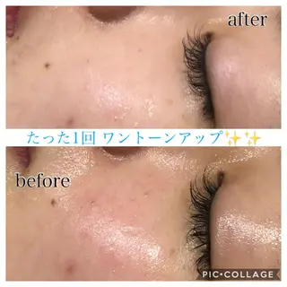 ロング カラー パーマ ヘアアレンジ キッズ ネイル マツエク・マツパ EnsorClair 代表 野口真央のエステ・リラクイメージ