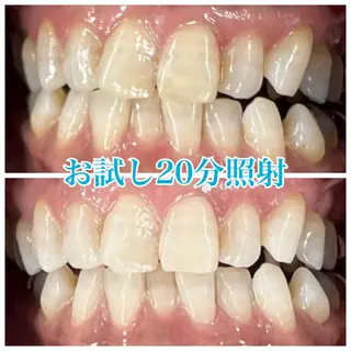 ホワイトニング🦷 ネイル💅LEAのその他イメージ