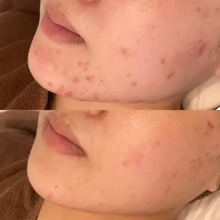 ハーブピーリング専門 BIOPLUS+川崎のエステ・リラクイメージ
