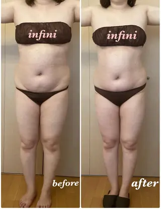 infini アンフィニのエステ・リラクイメージ