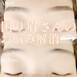 アイブロウ ハーブピーリング /KAEDEのエステ・リラクイメージ