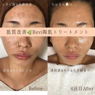 ショート カラー パーマ ヘアアレンジ メンズ キッズ ネイル マツエク・マツパ アイブロウ アイブロウサロン muni 福島区野田の眉毛・アイブロウイメージ