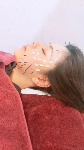 美容鍼灸女性専用 りんご鍼灸治療院のエステ・リラクイメージ