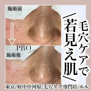 LULU ルルのエステ・リラクイメージ